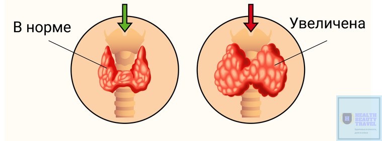 Щитовидная железа 