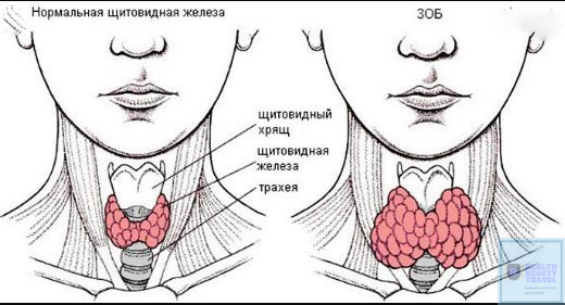 6 естественных способов поддержки щитовидной железы