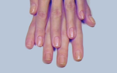 Значение цвета ногтей. Изменения на ногтевой поверхности